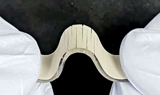 حسگر جدیدی که سکته مغزی را تشخیص می‌دهد
